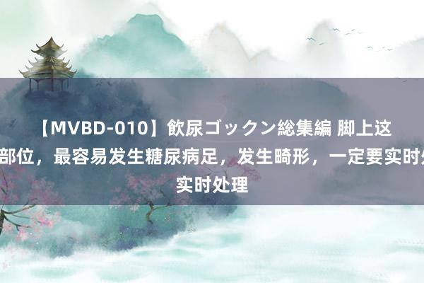 【MVBD-010】飲尿ゴックン総集編 脚上这3个部位，最容易发生糖尿病足，发生畸形，一定要实时处理